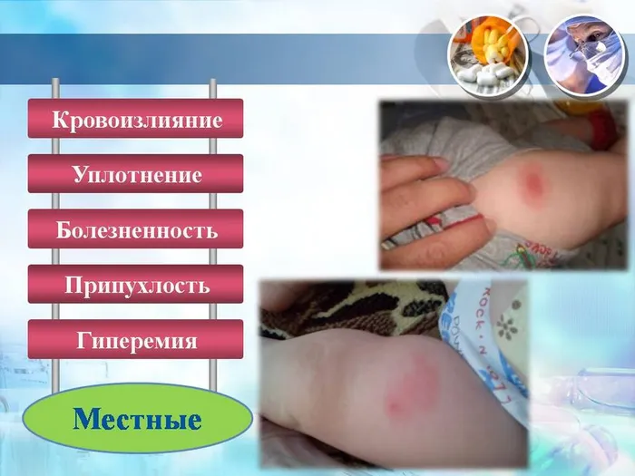 Слайд25